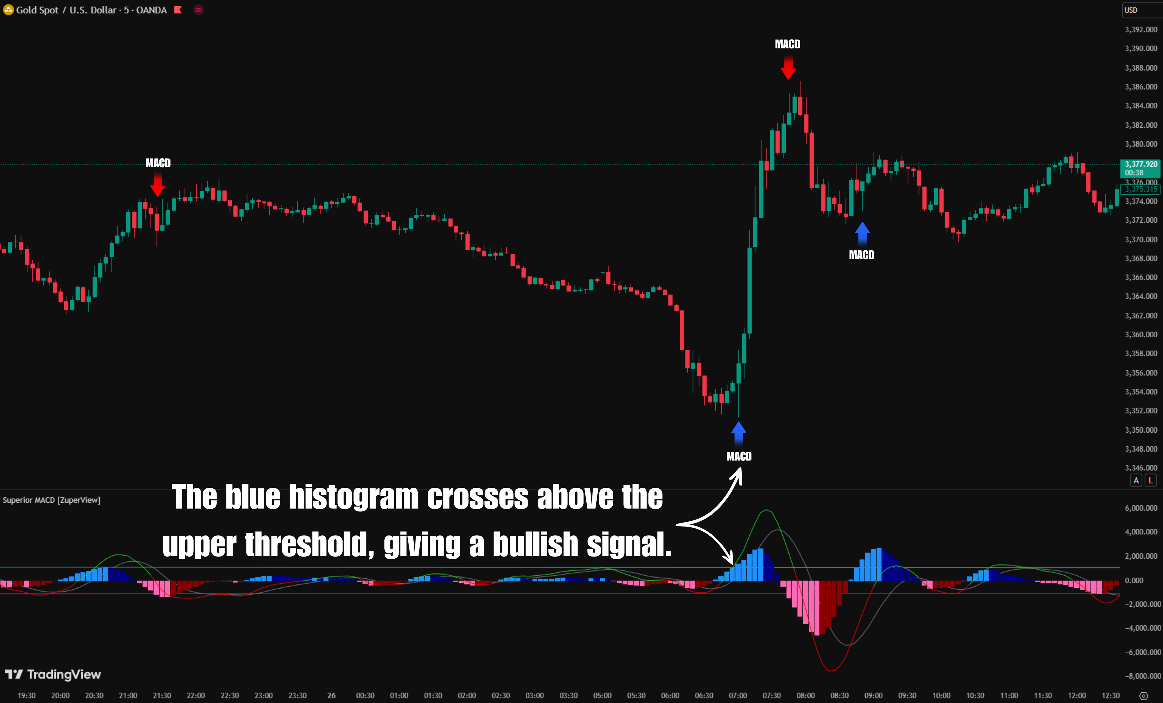 Superior MACD